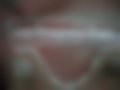 Pictures — 135 E 23